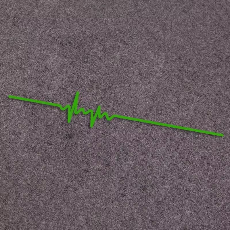 ECG Strip Car Sticker